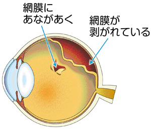 C6D7CF54-BCDE-42F5-AB6D-66D05C20BEEF.gif